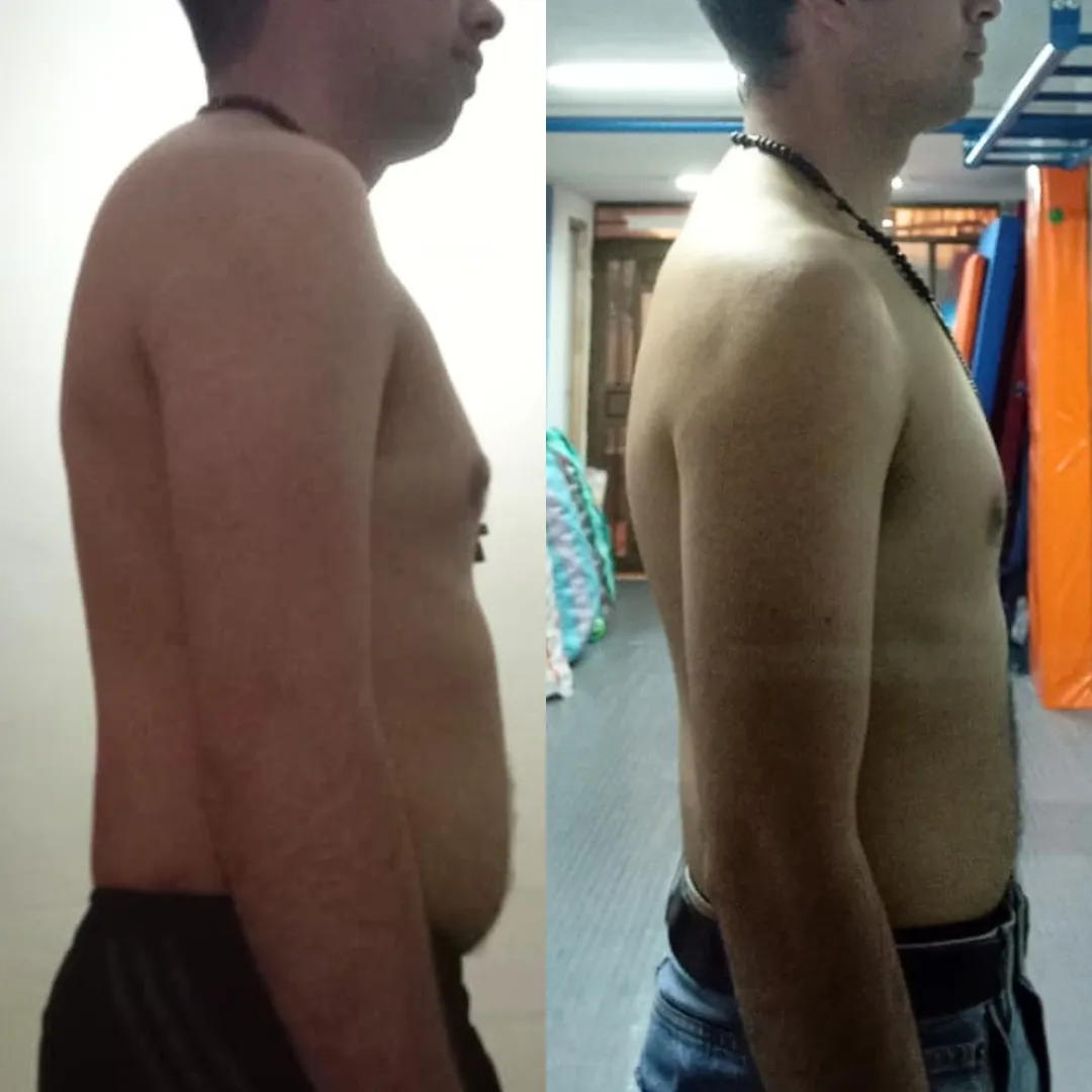 Antes y después — hombre 10