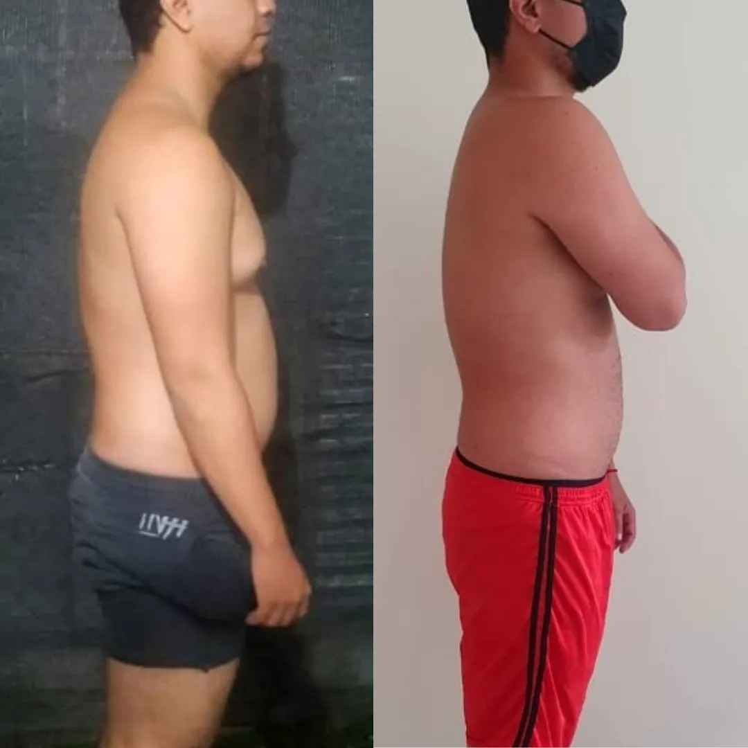 Antes y después — hombre 11