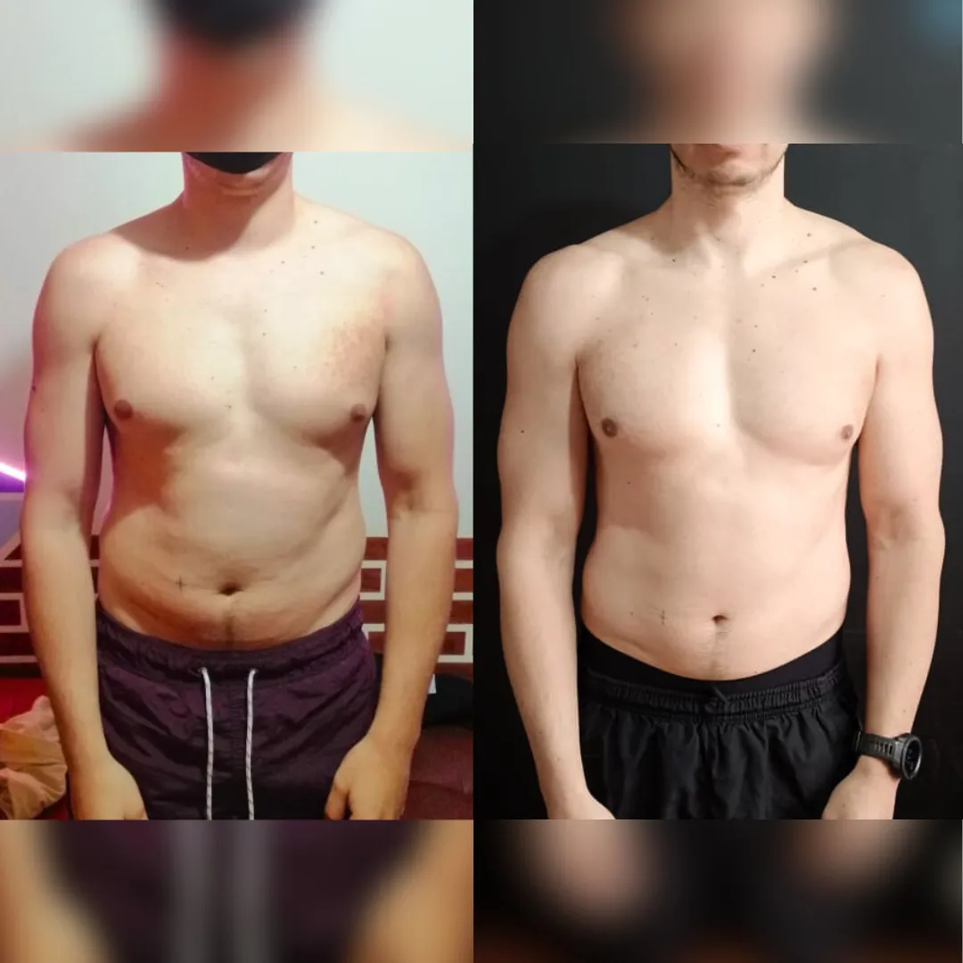 Antes y después — hombre 12