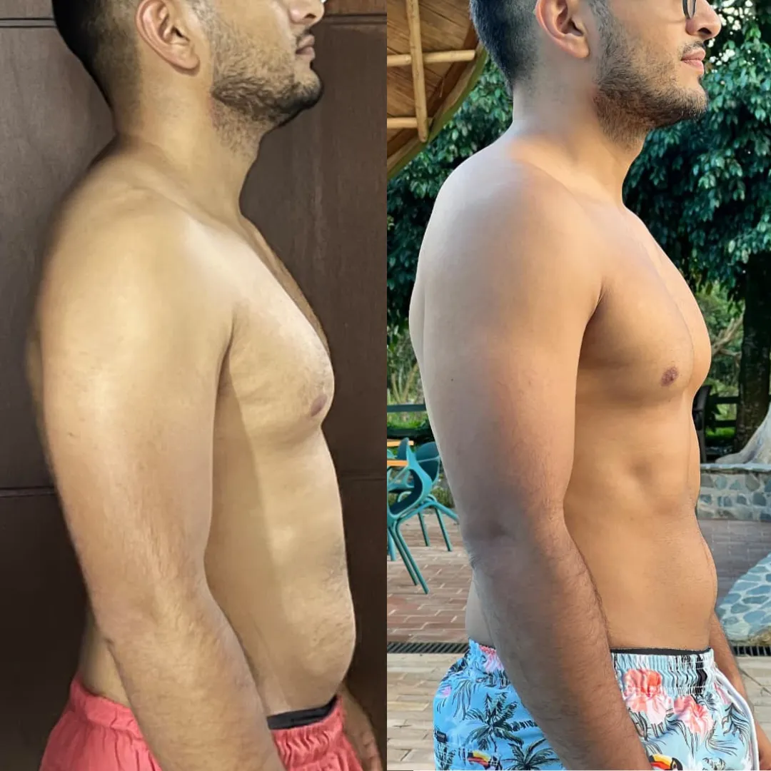 Antes y después — hombre 15