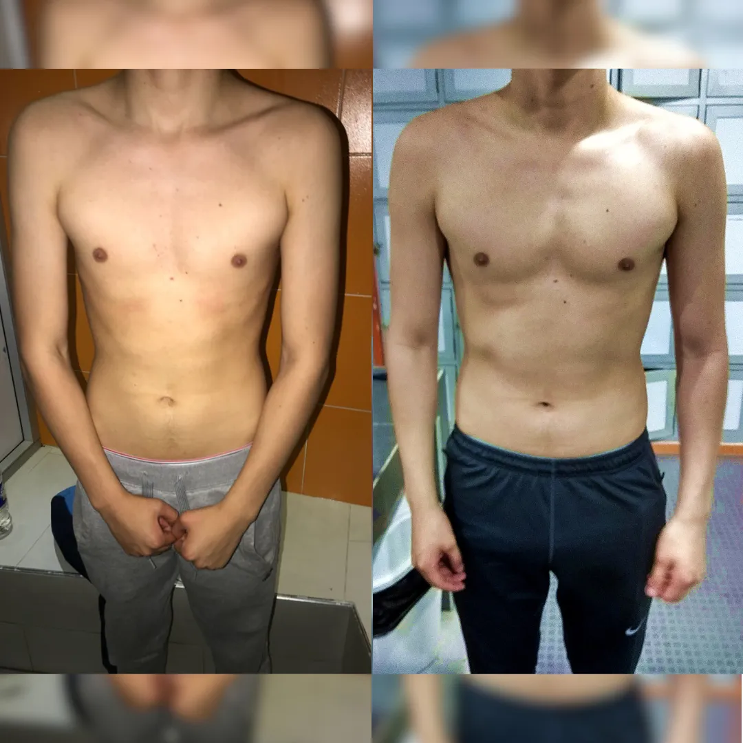 Antes y después — hombre 18