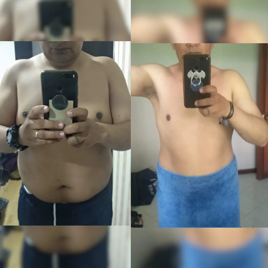 Antes y después — hombre 2