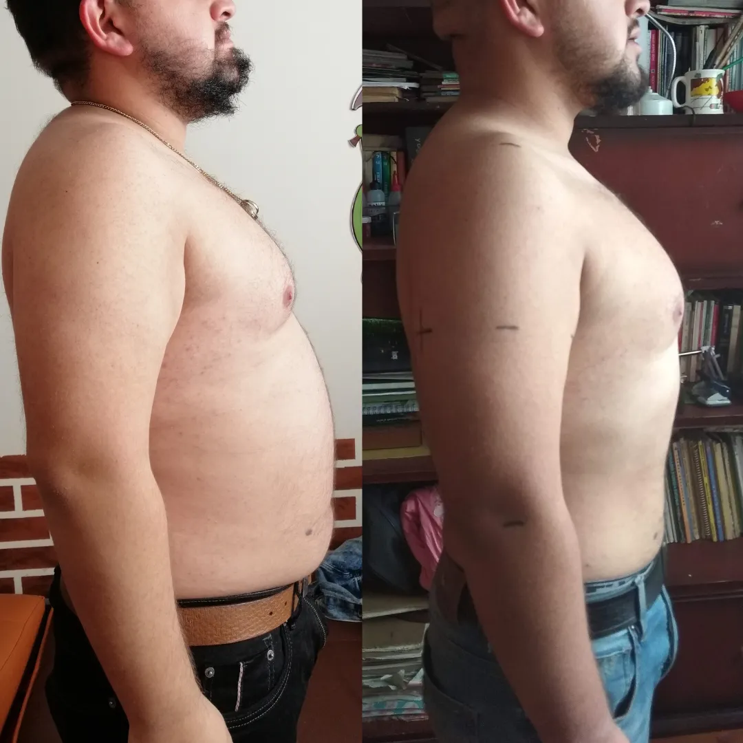 Antes y después — hombre 4