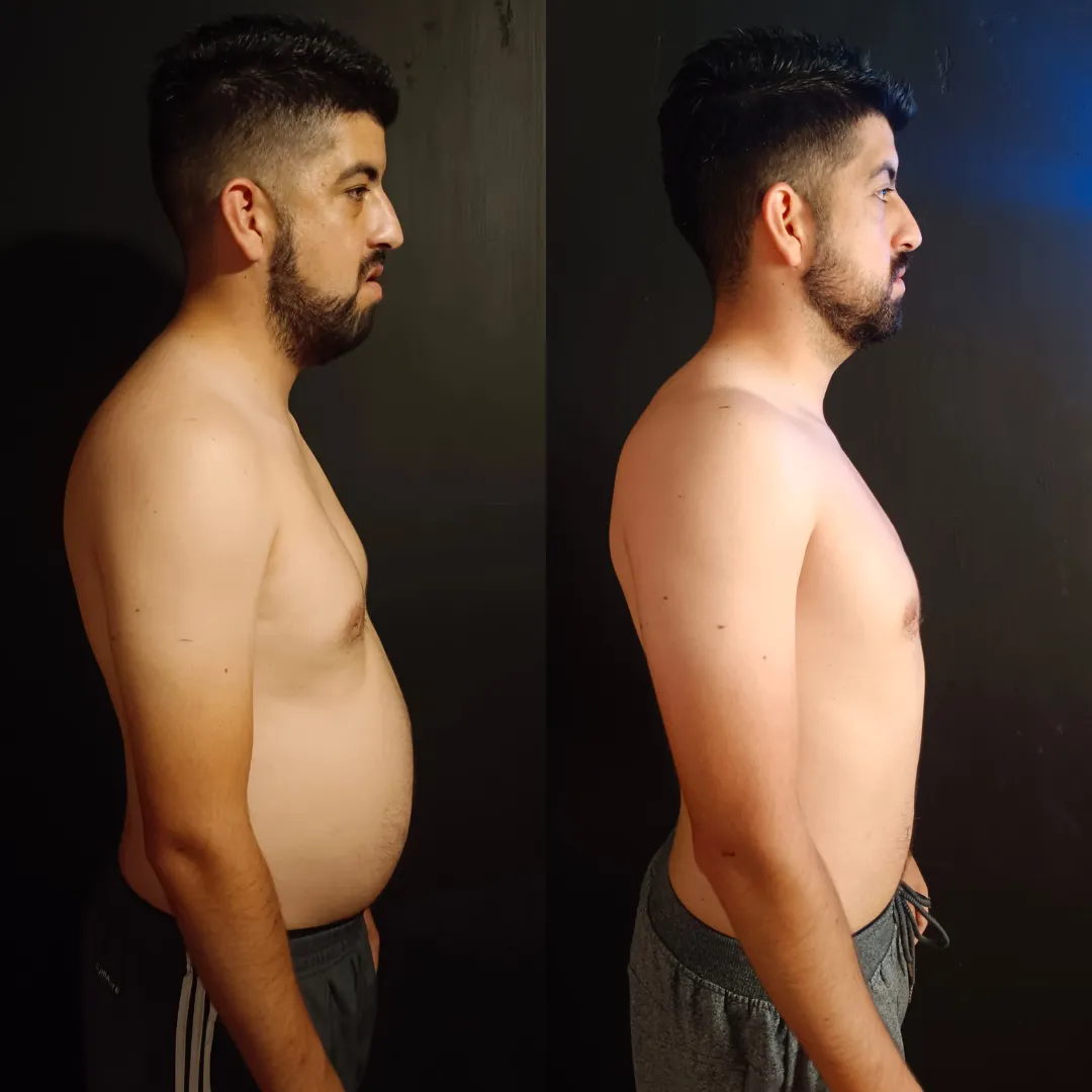 Antes y después — hombre 6