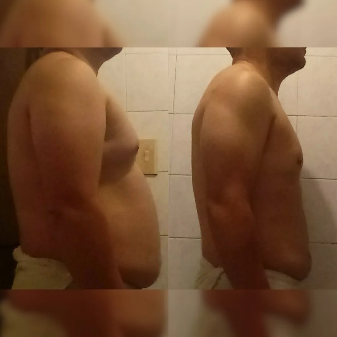 Antes y después — hombre 7