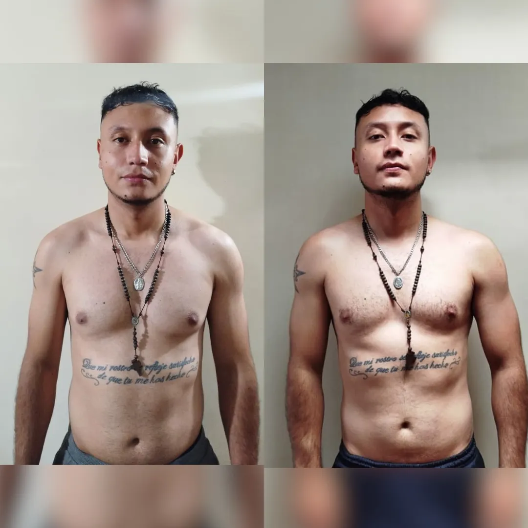 Antes y después — hombre 20