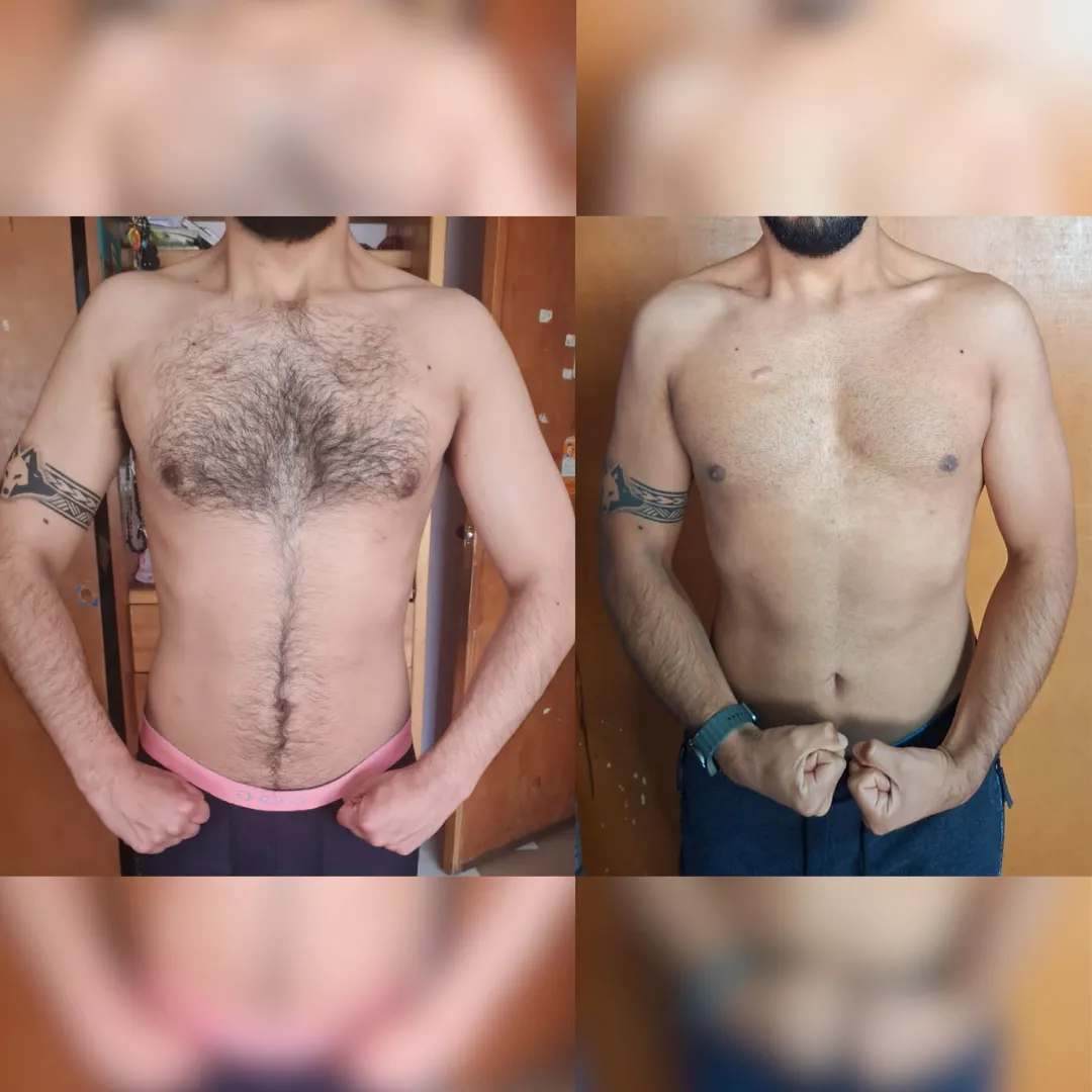 Antes y después — hombre 21
