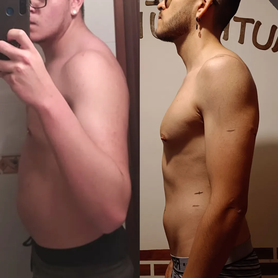 Antes y después — hombre 19