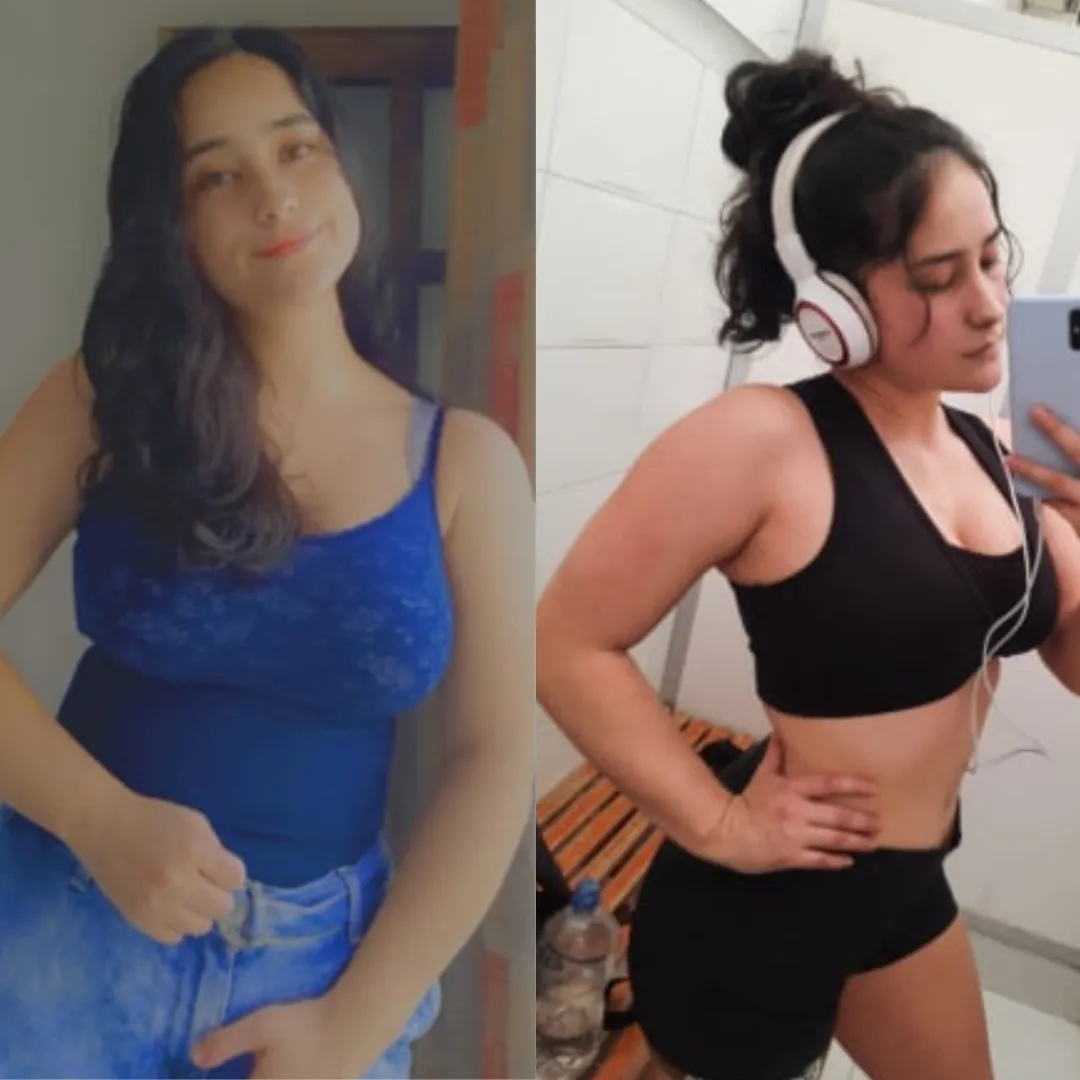 Antes y después — mujer 1