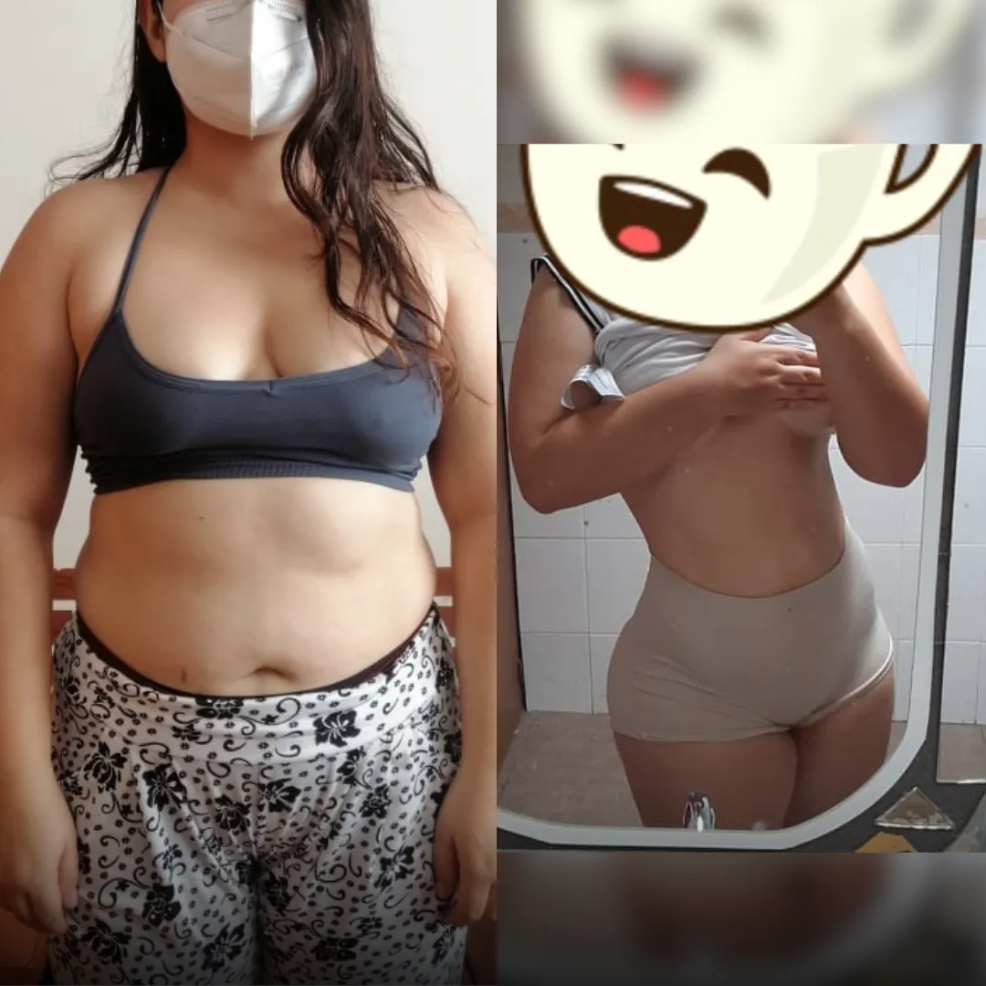 Antes y después — mujer 2