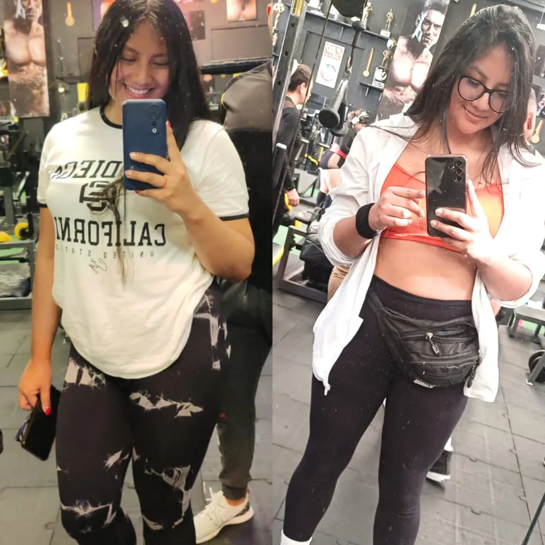 Antes y después — mujer 4