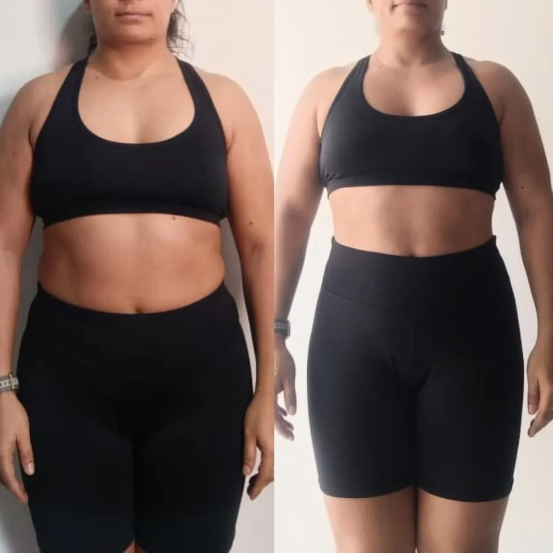 Antes y después — mujer 6