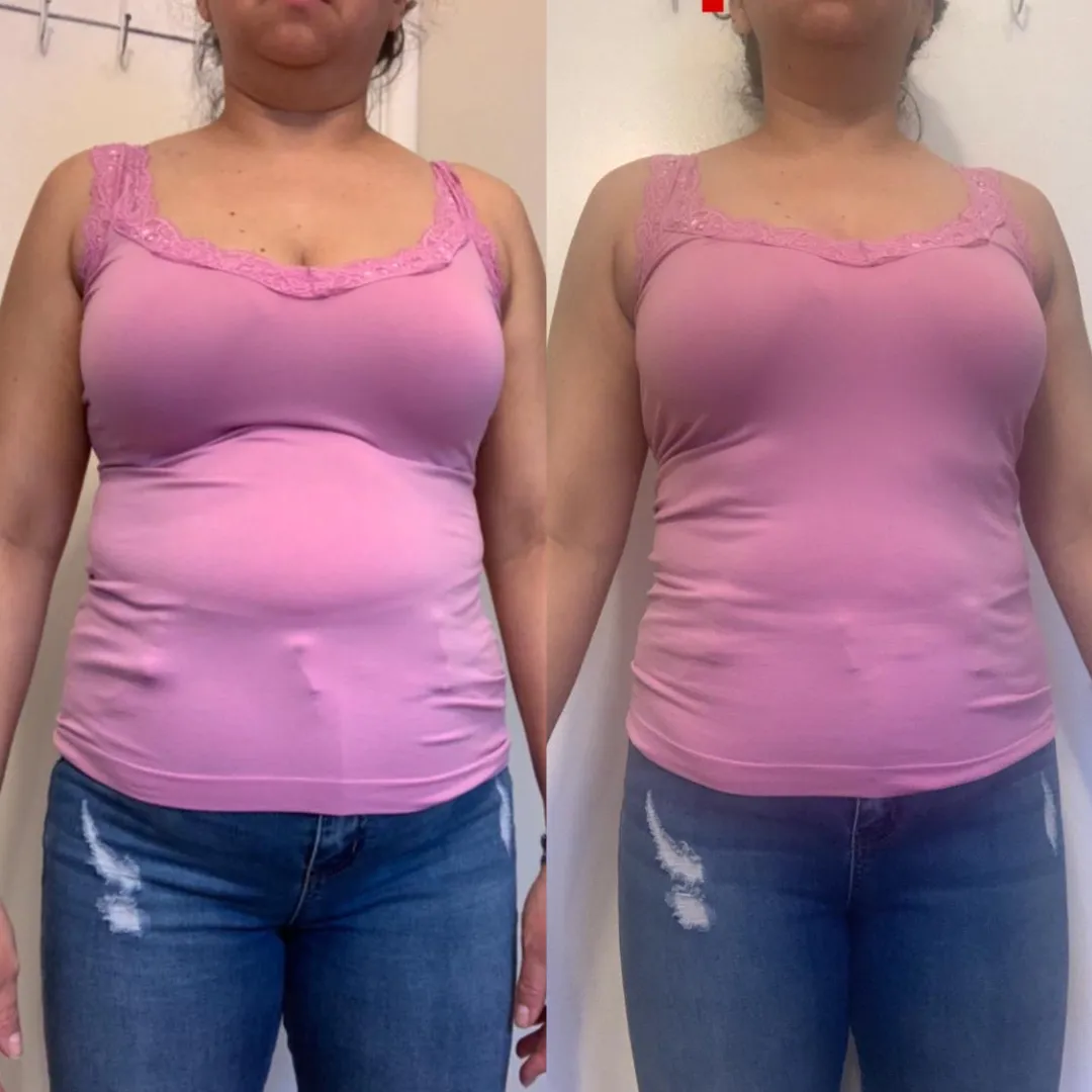 Antes y después — mujer 7