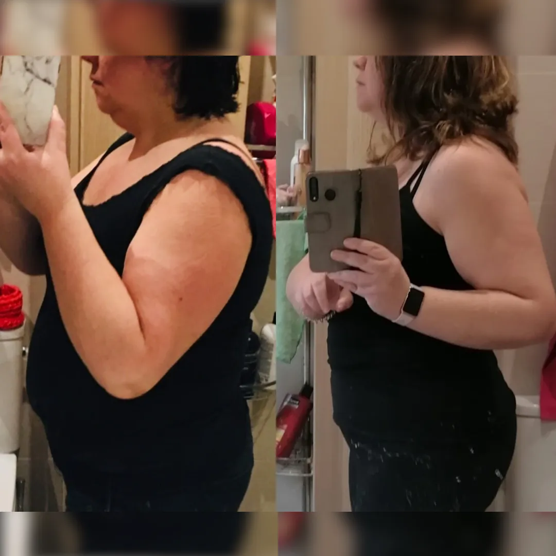 Antes y después — mujer 8