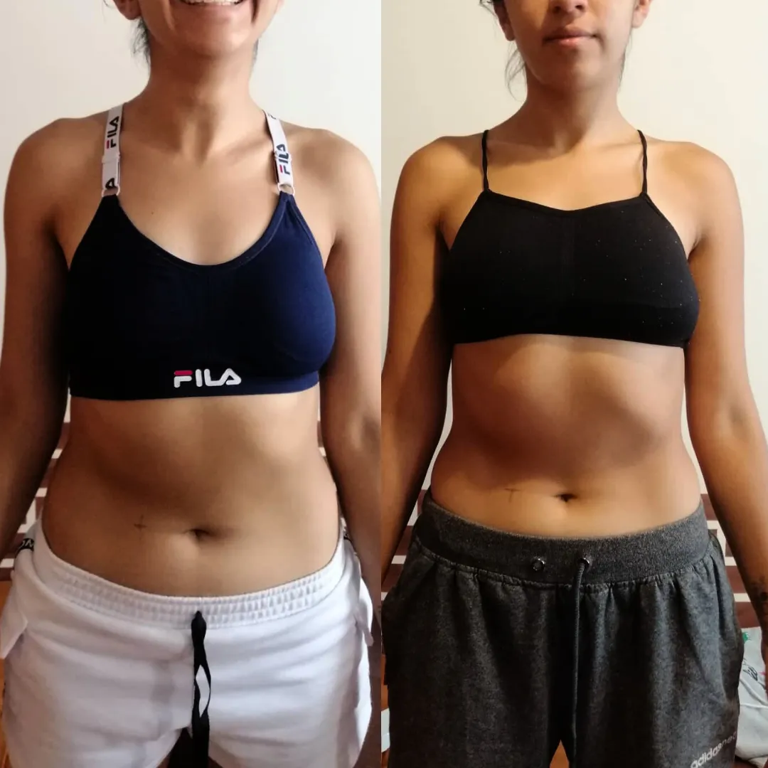 Antes y después — mujer 12