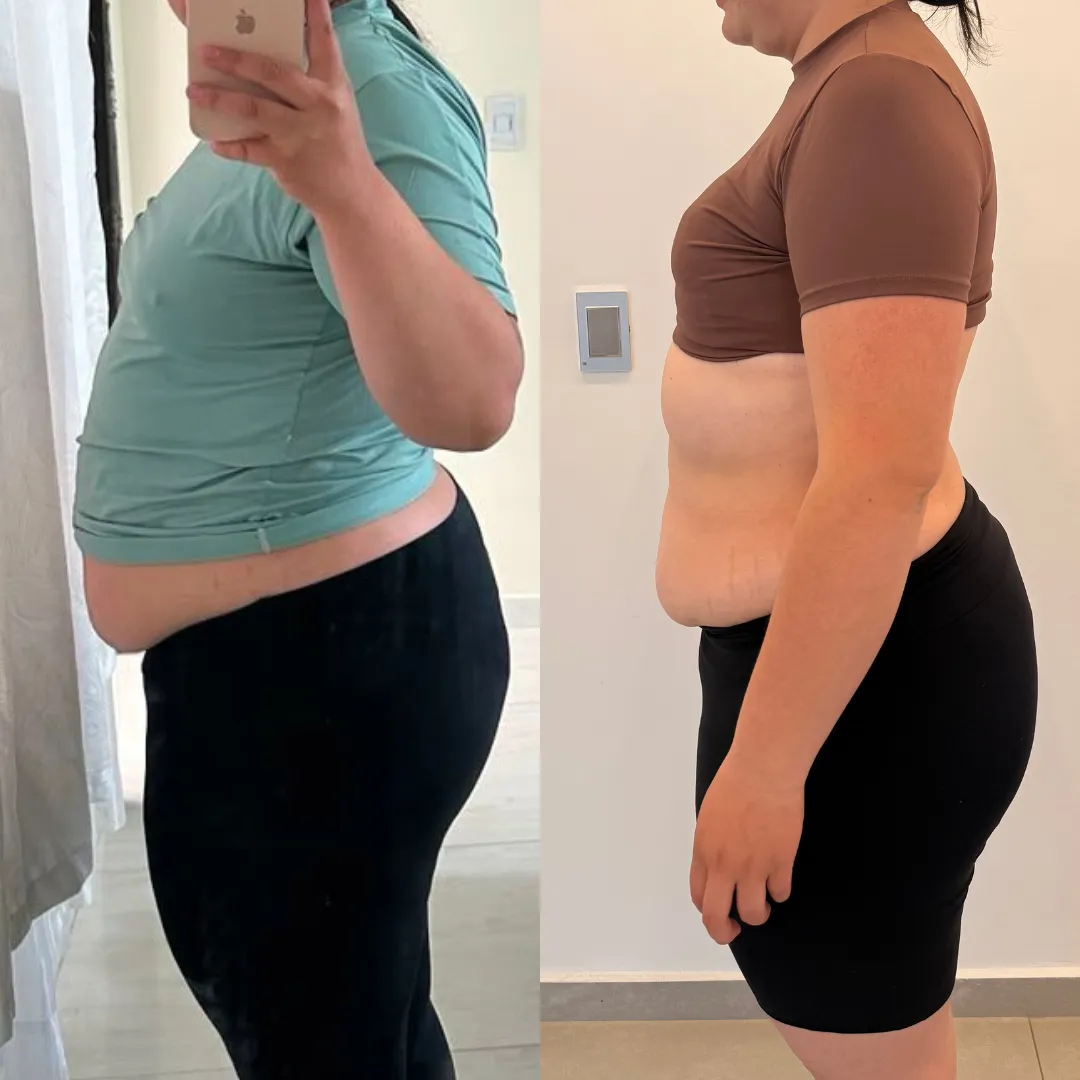 Antes y después — mujer 13