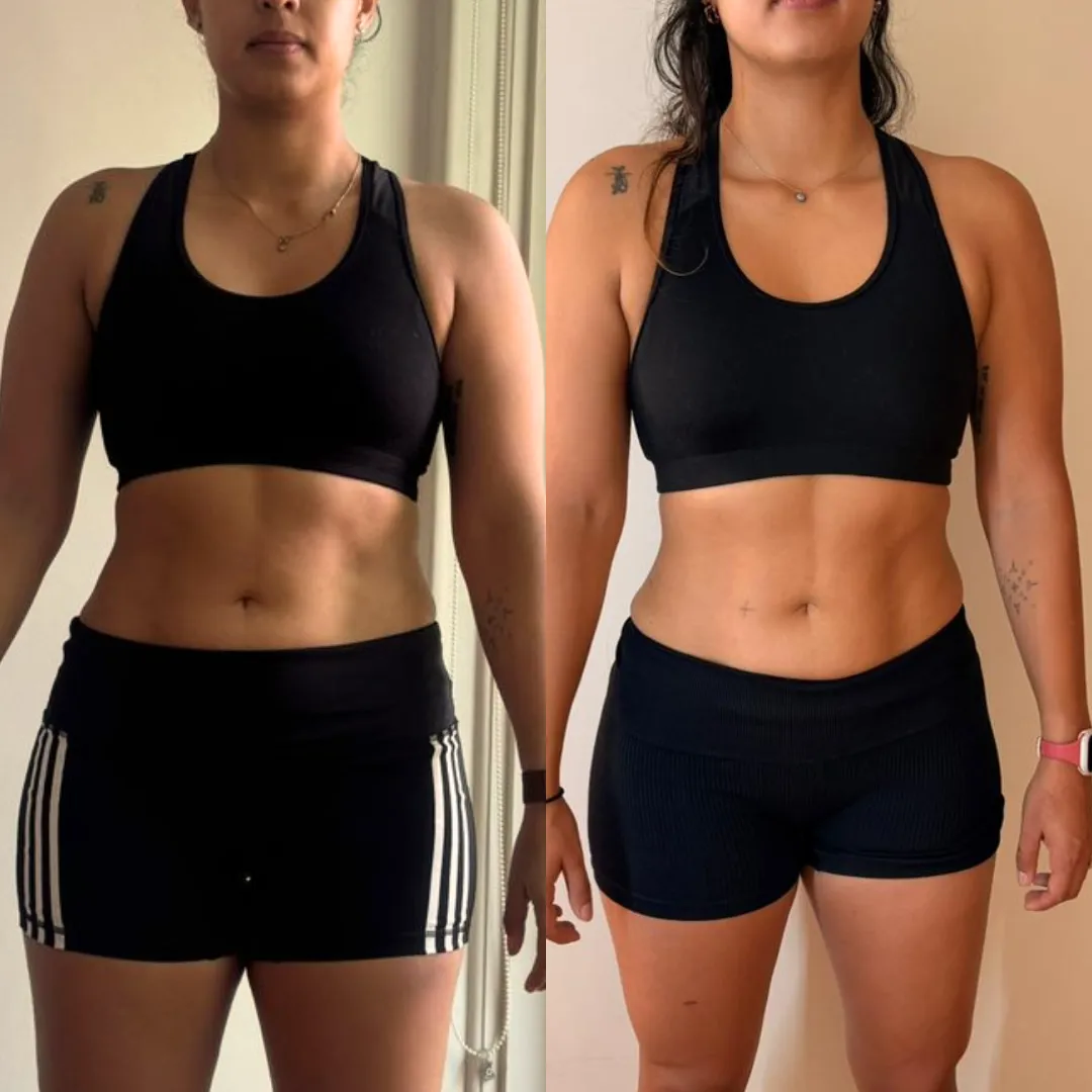 Antes y después — mujer 14