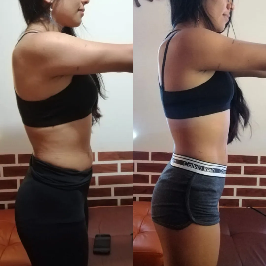 Antes y después — mujer 16