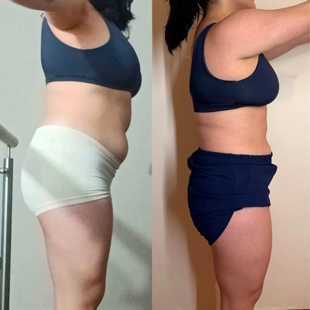 Antes y después — mujer 17