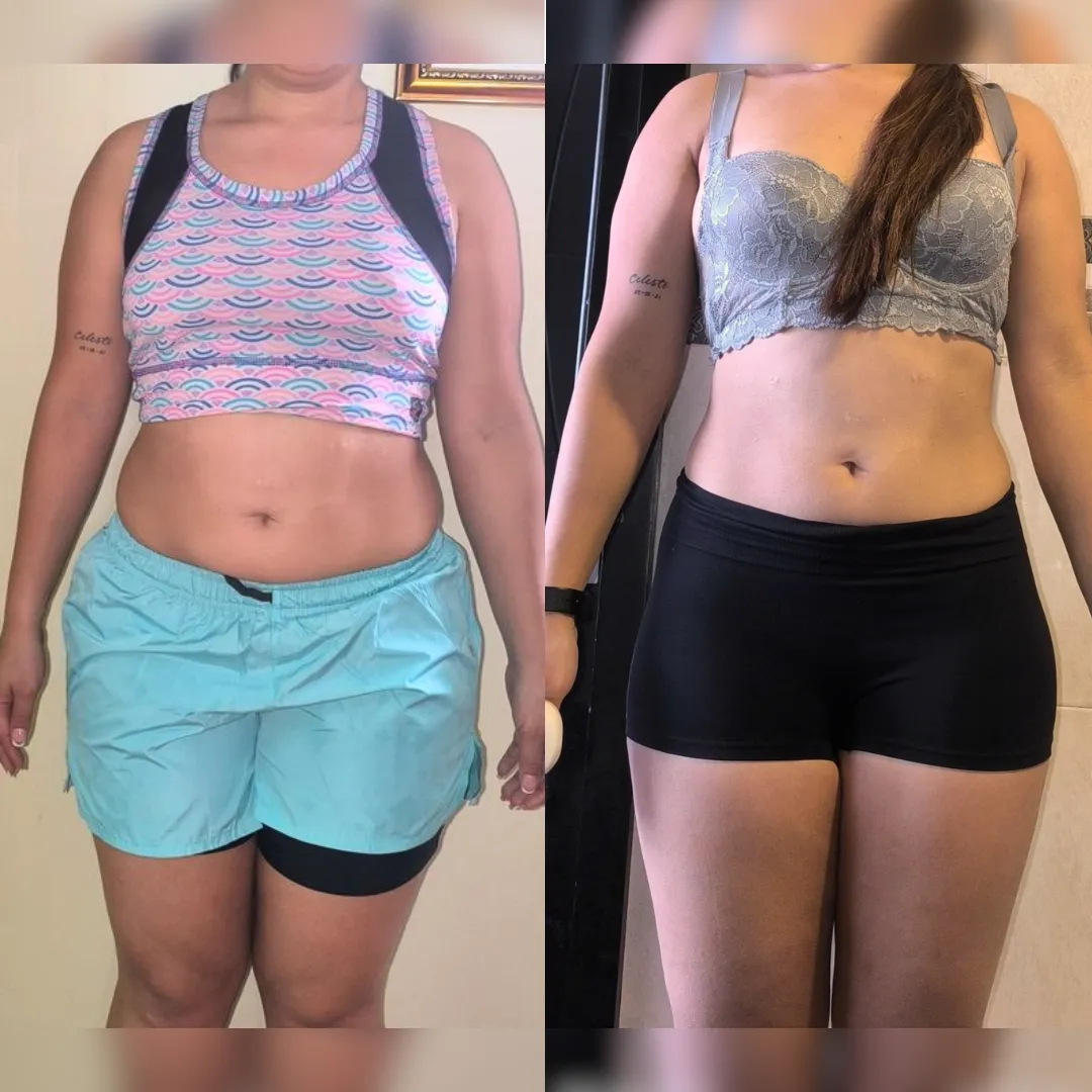 Antes y después — mujer 18